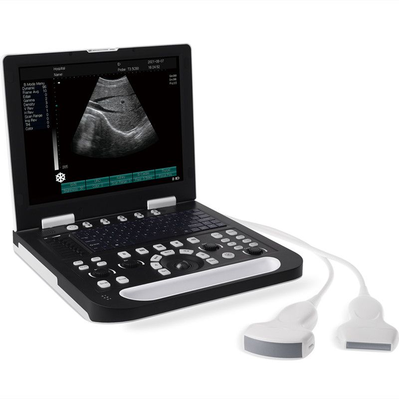 Ultrasonido Laptop Marshall Color Y Pulsado Con Transductor Nuevo